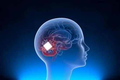 脑机接口技术的安全挑战探索潜在风险与保护措施